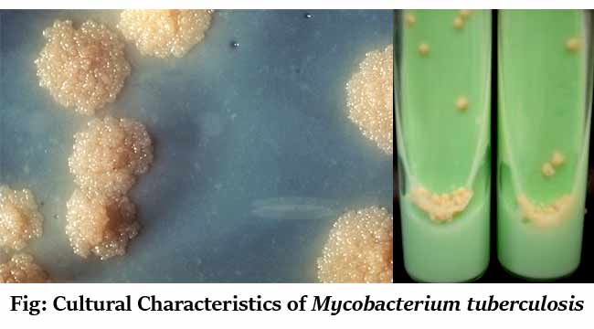 Cultural Characteristics of Mycobacterium tuberculosis