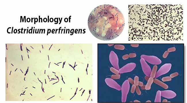 Morphology of Clostridium perfringens