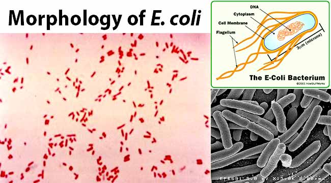 Morphology of E. coli