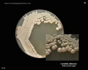 Candida albicans on SDA