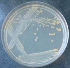 E. coli on Nutrient Agar (NA)