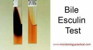 Bile Esculin Test- Principle, Procedure and Result Interpretation