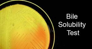 Bile Solubility Test- Principle, Procedure and Result Interpretation