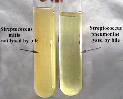 Bile Solubility Test-Test Tube Method