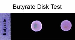 Butyrate Disk Test- Principle, Procedure and Result Interpretation