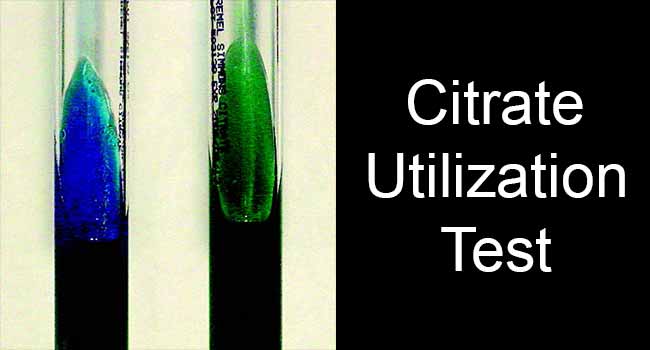 Citrate Utilization Test- Principle, Procedure and Result Interpretation