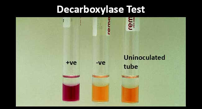 Decarboxylase Test