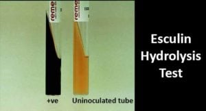 Esculin Hydrolysis Test- Principle, Procedure and Result Interpretation