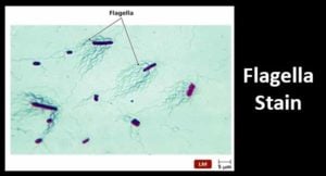 Flagella Stain- Principle, Procedure and Result Interpretation