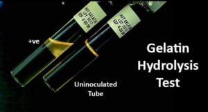 Gelatin Hydrolysis Test- Principle, Procedure and Result Interpretation