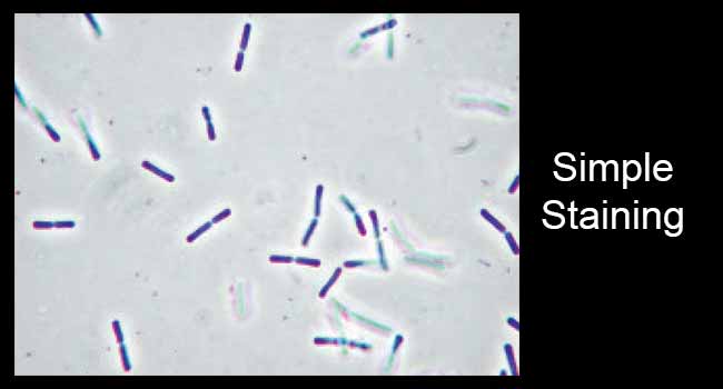 Methylene Blue Stain Bacteria