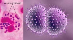 Habitat and Morphology of Neisseria gonorrhoeae