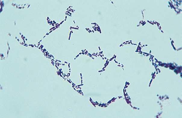 Gram stain of Bacillus cereus