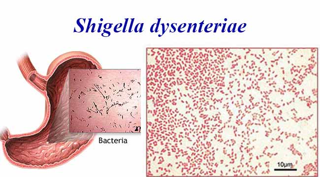 Shigella Bacteria Gram Stain