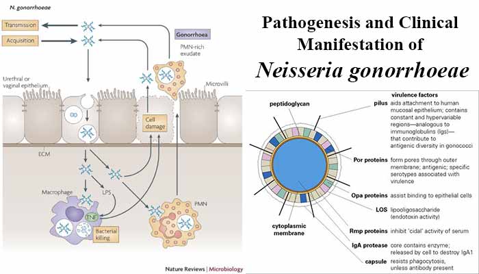 Pathogenesis and Clinical Manifestation of Neisseria gonorrhoeae