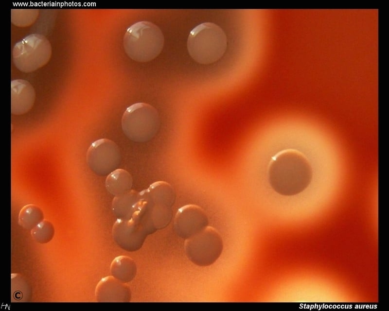 Staphylococcus aureus colonies on blood agar, beta-hemolysis