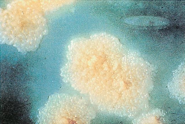 Colony morphology of Mycobacterium tuberculosis  Lowenstein Jensen agar after 8 weeks of medium