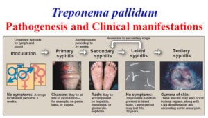 Pathogenesis and Clinical manifestations of Treponema pallidum