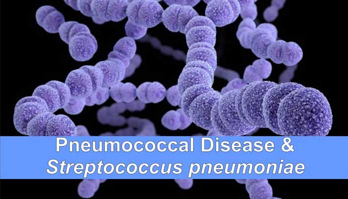 Virulence factors, Pathogenesis and Clinical manifestations of Streptococcus pneumoniae