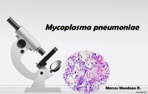 Laboratory diagnosis, Treatment and Prevention of Mycoplasma pneumoniae
