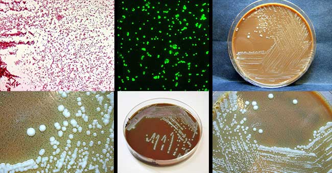 Laboratory diagnosis of Francisella tularensis