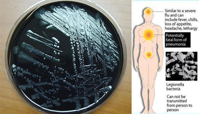 Laboratory diagnosis of Legionella pneumophila