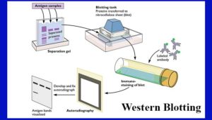 Western blotting- Introduction, Principle and Applications