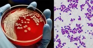 Biochemical Test of Staphylococcus aureus