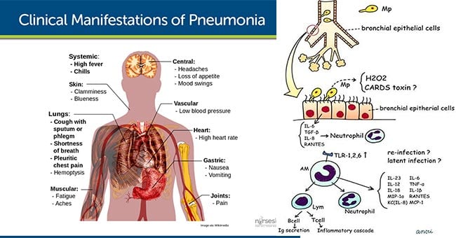 Pathogenesis and Clinical Manifestations of Mycoplasma pneumoniae