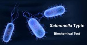 Biochemical Test of Salmonella Typhi