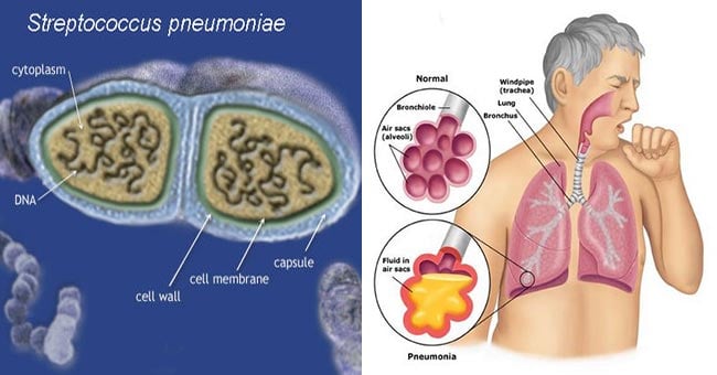 strep throat bacteria shape