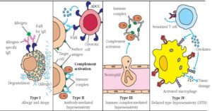 Hypersensitivity- Introduction, Causes, Mechanism and Types