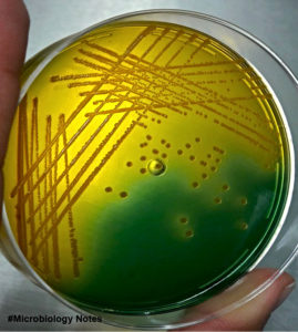 Vibrio cholerae (Owaga) on TCBS Agar