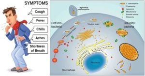  Virulence factors, Pathogenesis and Clinical manifestations of Legionella pneumophila