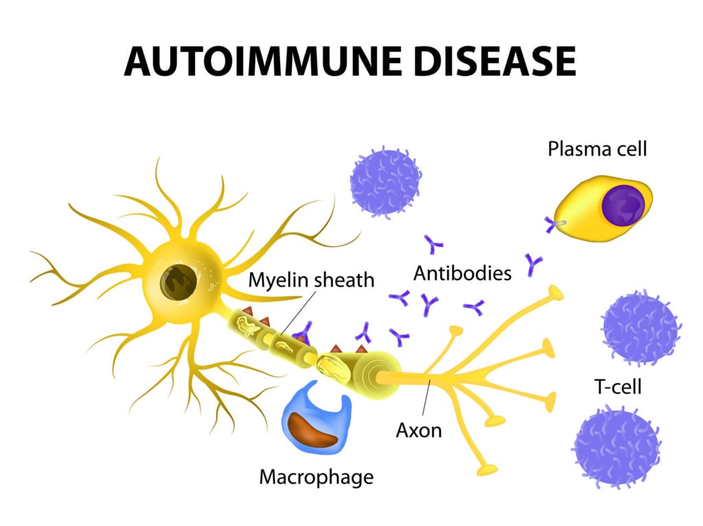 Autoimmune Disease