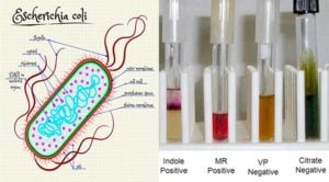 Biochemical Test of Escherichia coli (E. coli)