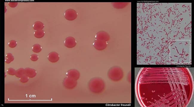 Biochemical test of Citrobacter freundii