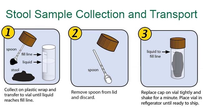 Collection and transport of stool specimens