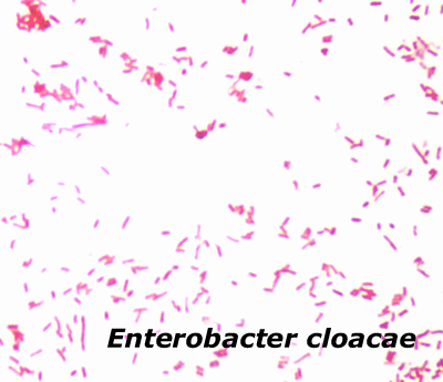 Enterobacter cloacae Gram Stain