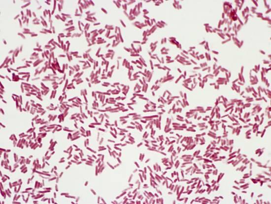 Escherichia coli (E. coli) Gram Stain