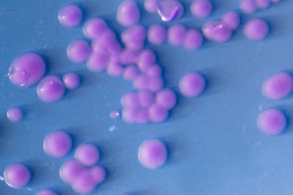 Streptococcus viridans férfiak kenetében