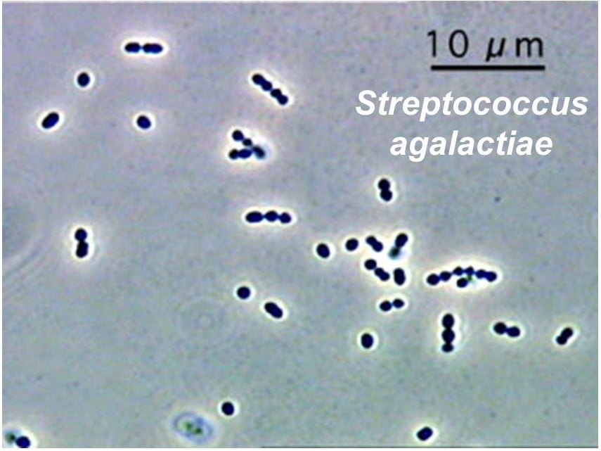 Streptococcus agalactiae
