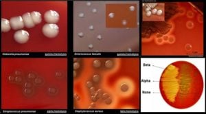 Blood Agar- Composition, Principle, Preparation and Uses
