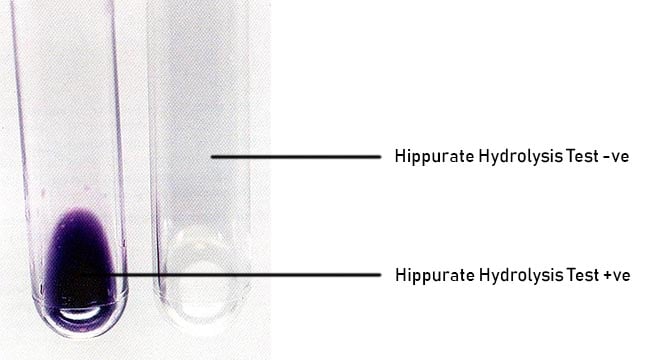 Result Interpretation of Hippurate Hydrolysis Test