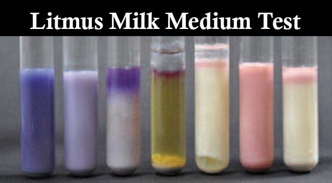 Result Interpretation of Litmus Milk Medium Test