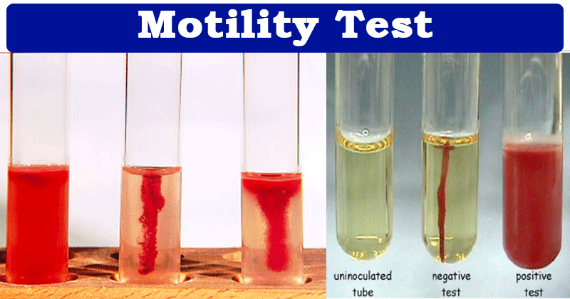 Motility Test- Principle, Procedure and Results