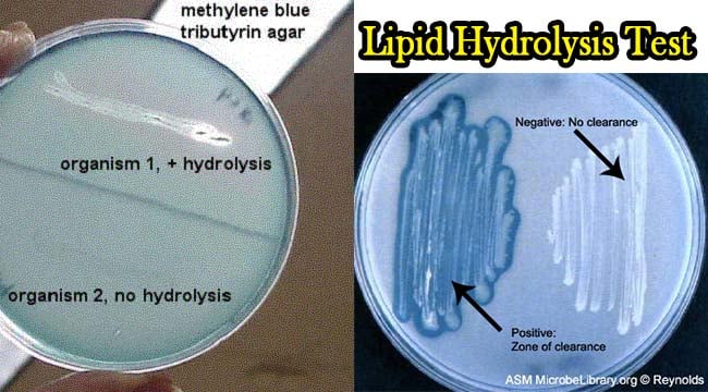 Result Interpretation of Lipid Hydrolysis Test