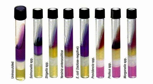 Result Interpretation of Lysine Iron Agar Test