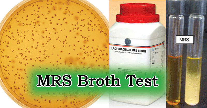 Result Interpretation of MRS Broth Test