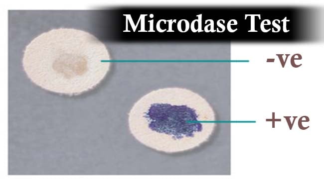 Result Interpretation of Microdase (Modified Oxidase) Test